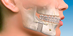 Maxilofacial